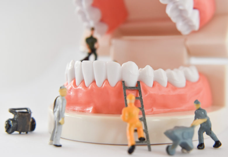teeth model with tiny workers on it